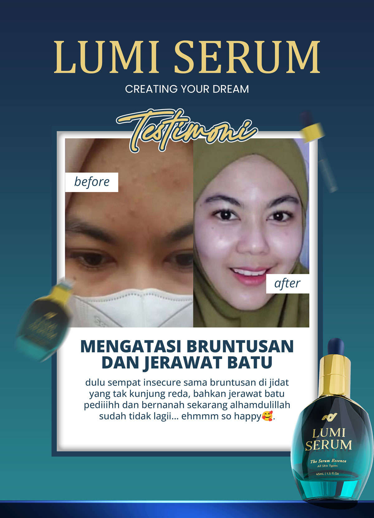 testi